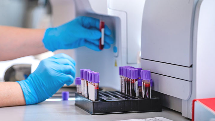 آگهی استخدام تفسیر آزمایش شمارش کامل خون (CBC) در حیوانات کوچک در نامشخص از شرکت 